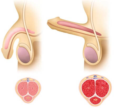 Mechanizmus erekcie - ako vzniká erekcia
