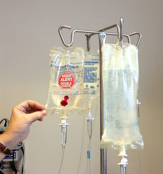 Liečba chemoterapiou podávaná vo forme infúzie